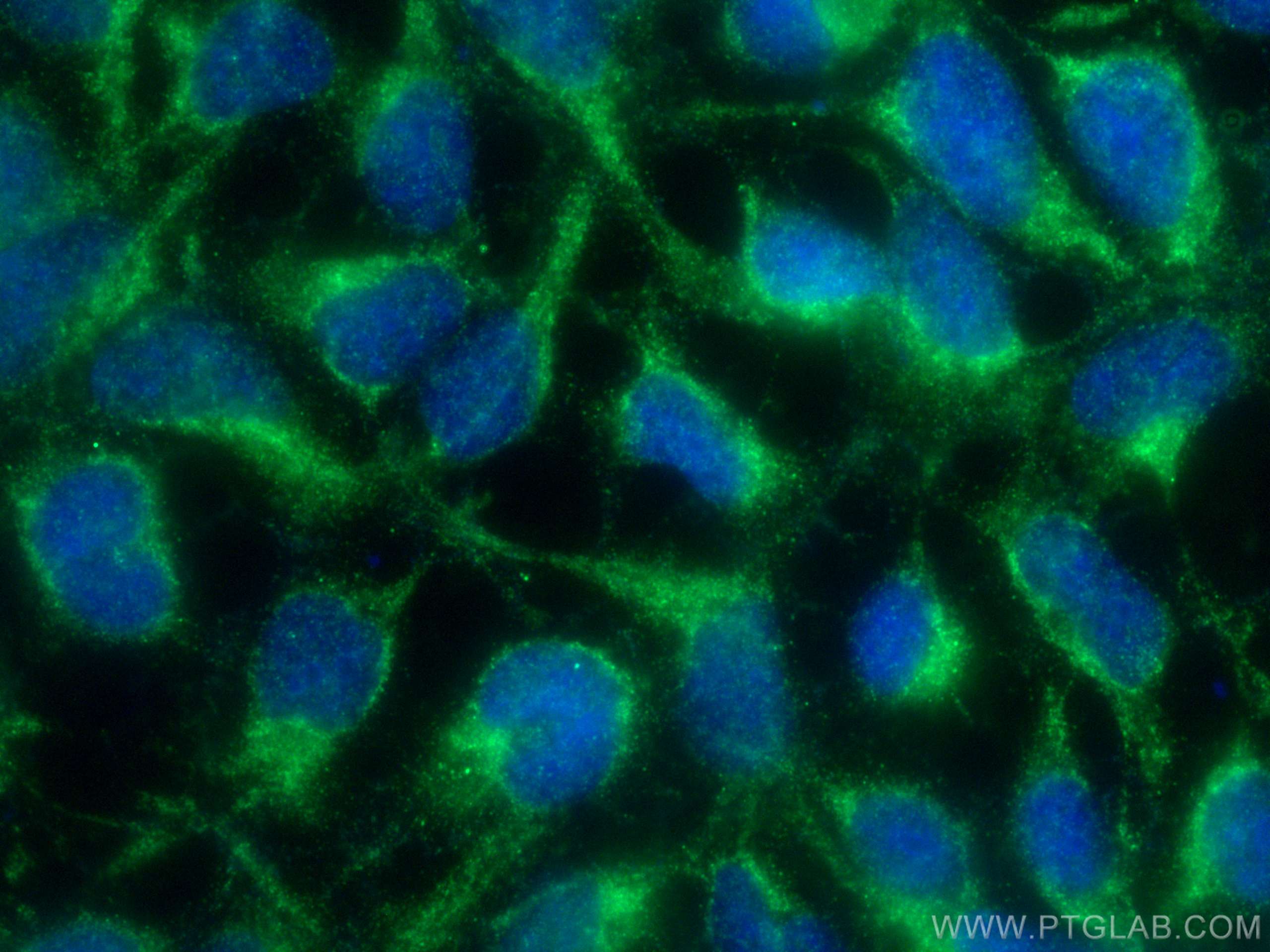 IF Staining of HEK-293 using 23394-1-AP