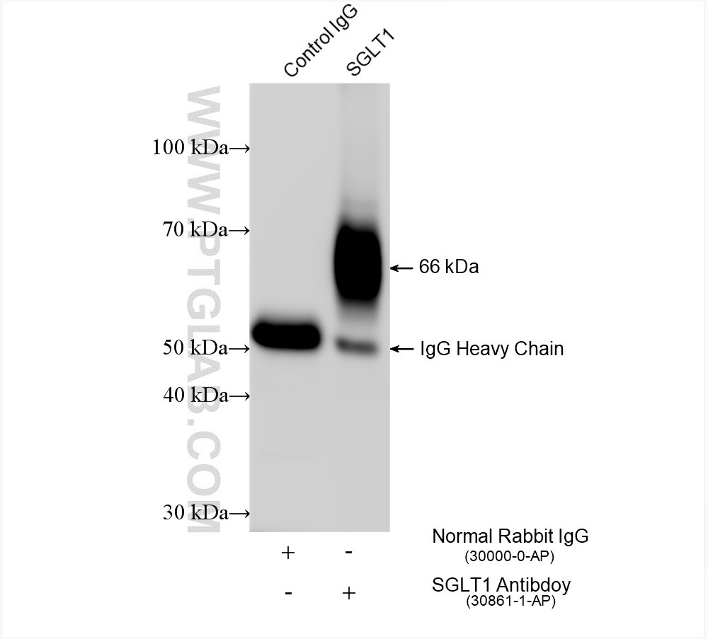 SGLT1 antibody (30861-1-AP) | Proteintech | 武汉三鹰生物技术有限公司