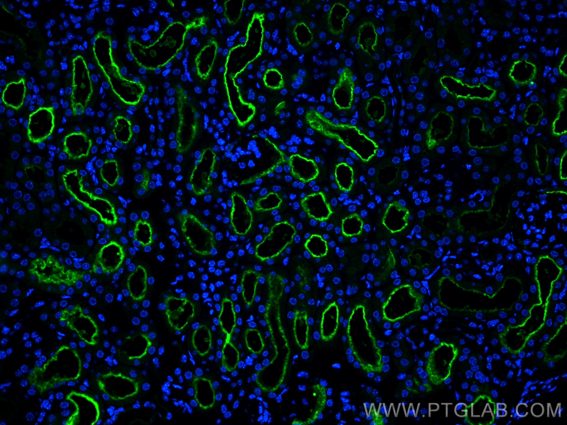 IF Staining of mouse kidney using 24654-1-AP