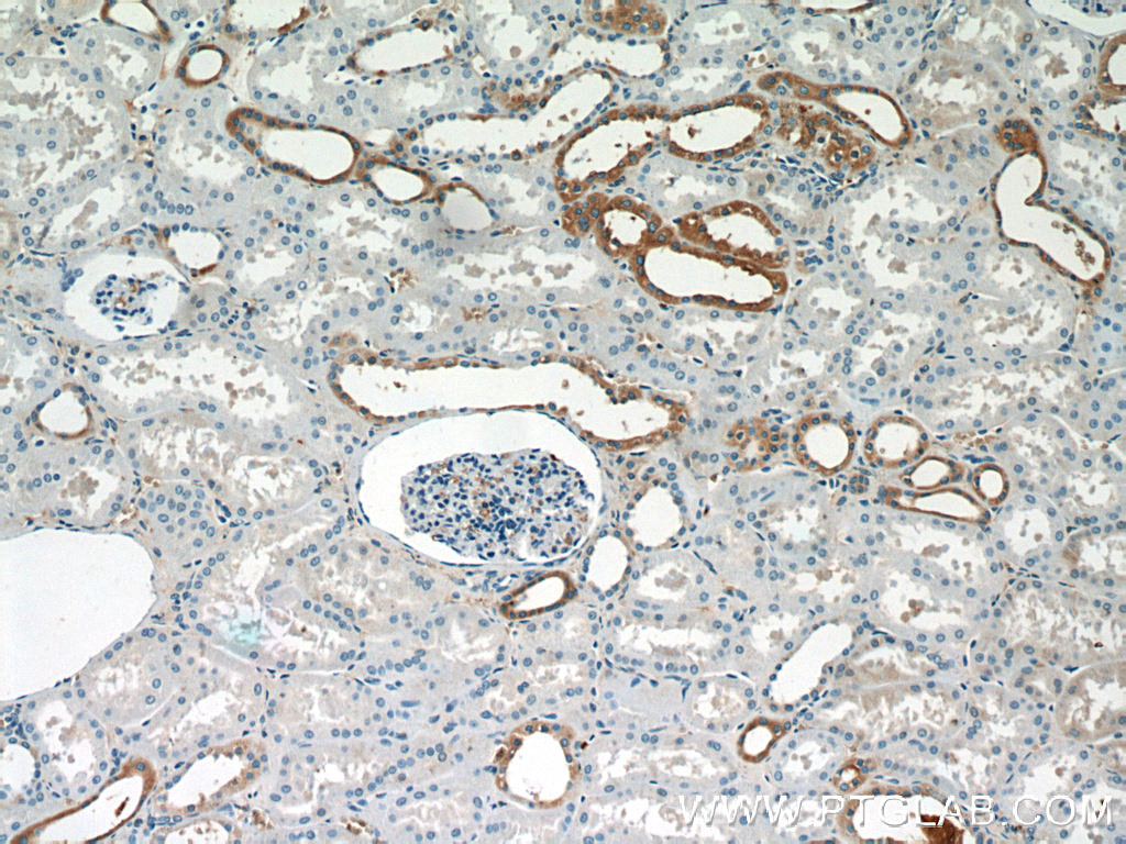 IHC staining of human kidney using 24327-1-AP