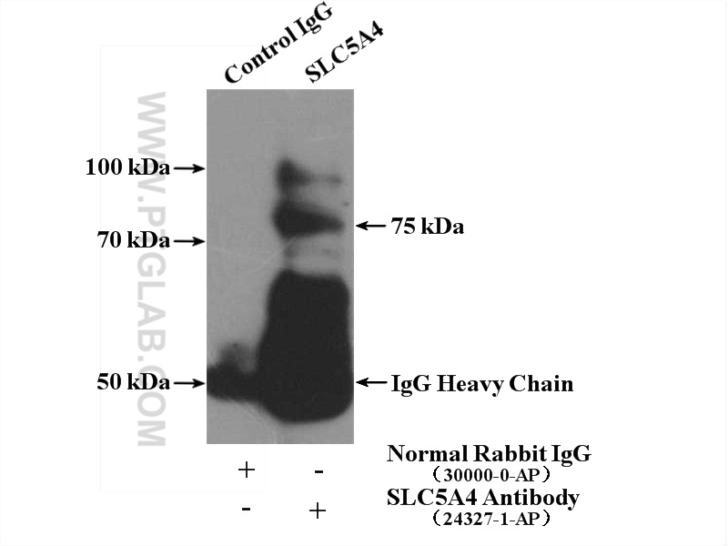 IP experiment of mouse kidney using 24327-1-AP