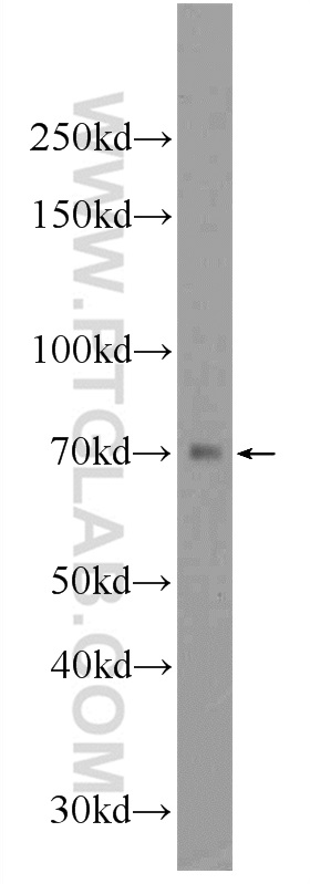 WB analysis of mouse kidney using 24327-1-AP