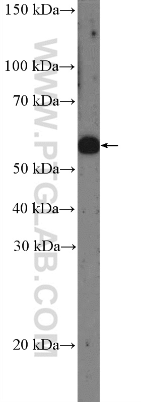 WB analysis of HEK-293 using 14184-1-AP