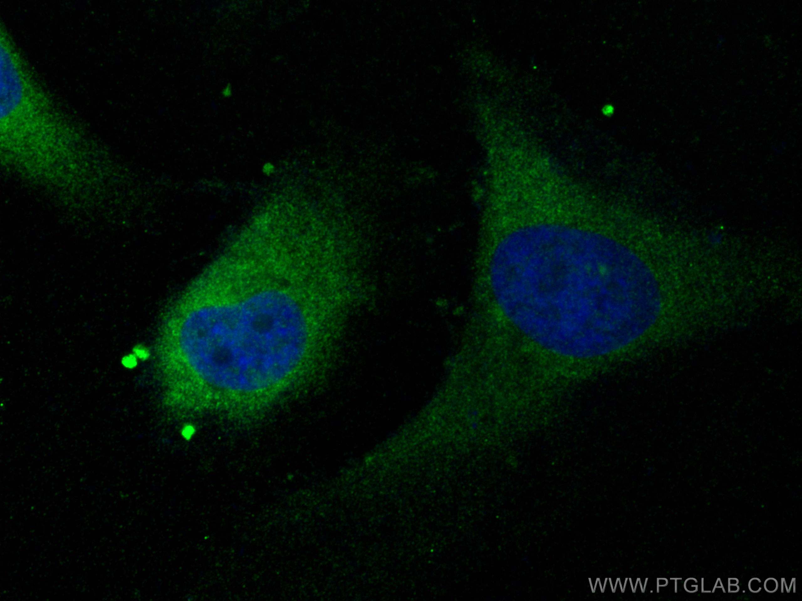 IF Staining of HeLa using 11019-2-AP