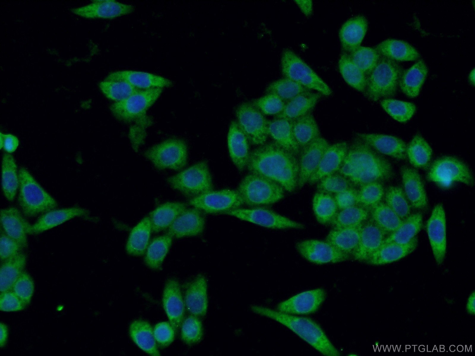 IF Staining of HeLa using 60305-1-Ig (same clone as 60305-1-PBS)