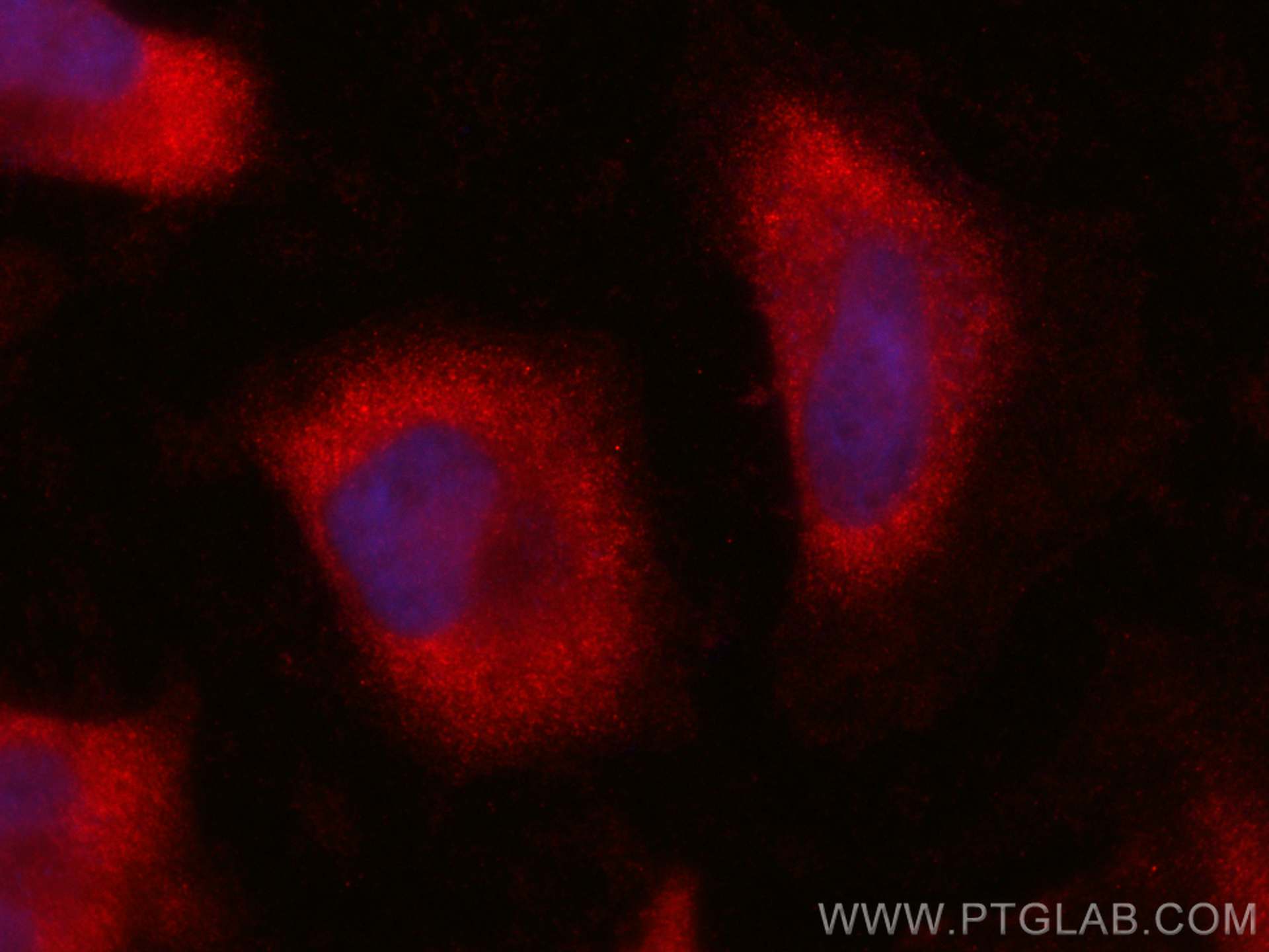 IF Staining of HeLa using CL594-60305