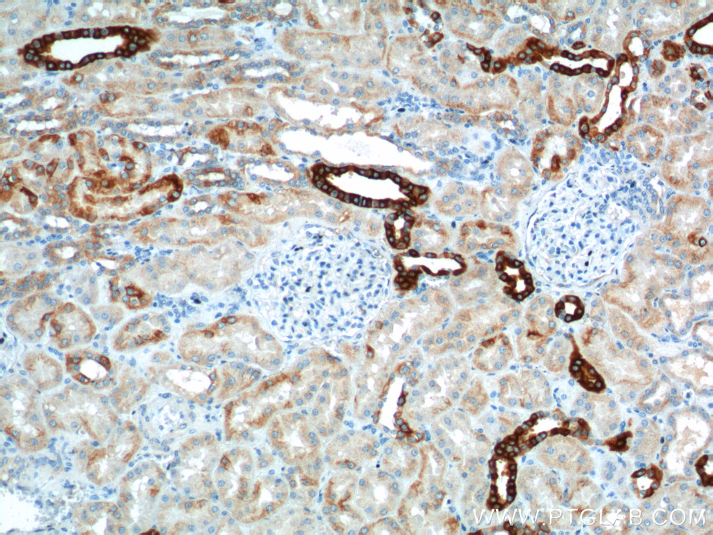 IHC staining of human kidney using 11871-1-AP