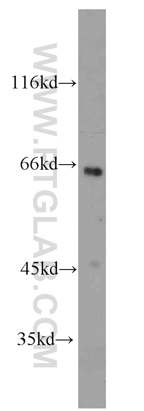 WB analysis of HeLa using 15641-1-AP