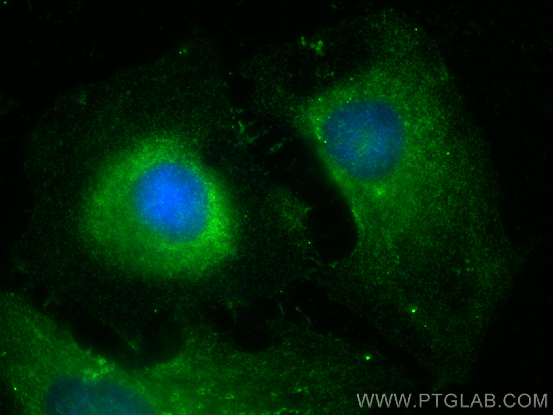 IF Staining of HeLa using 15957-1-AP