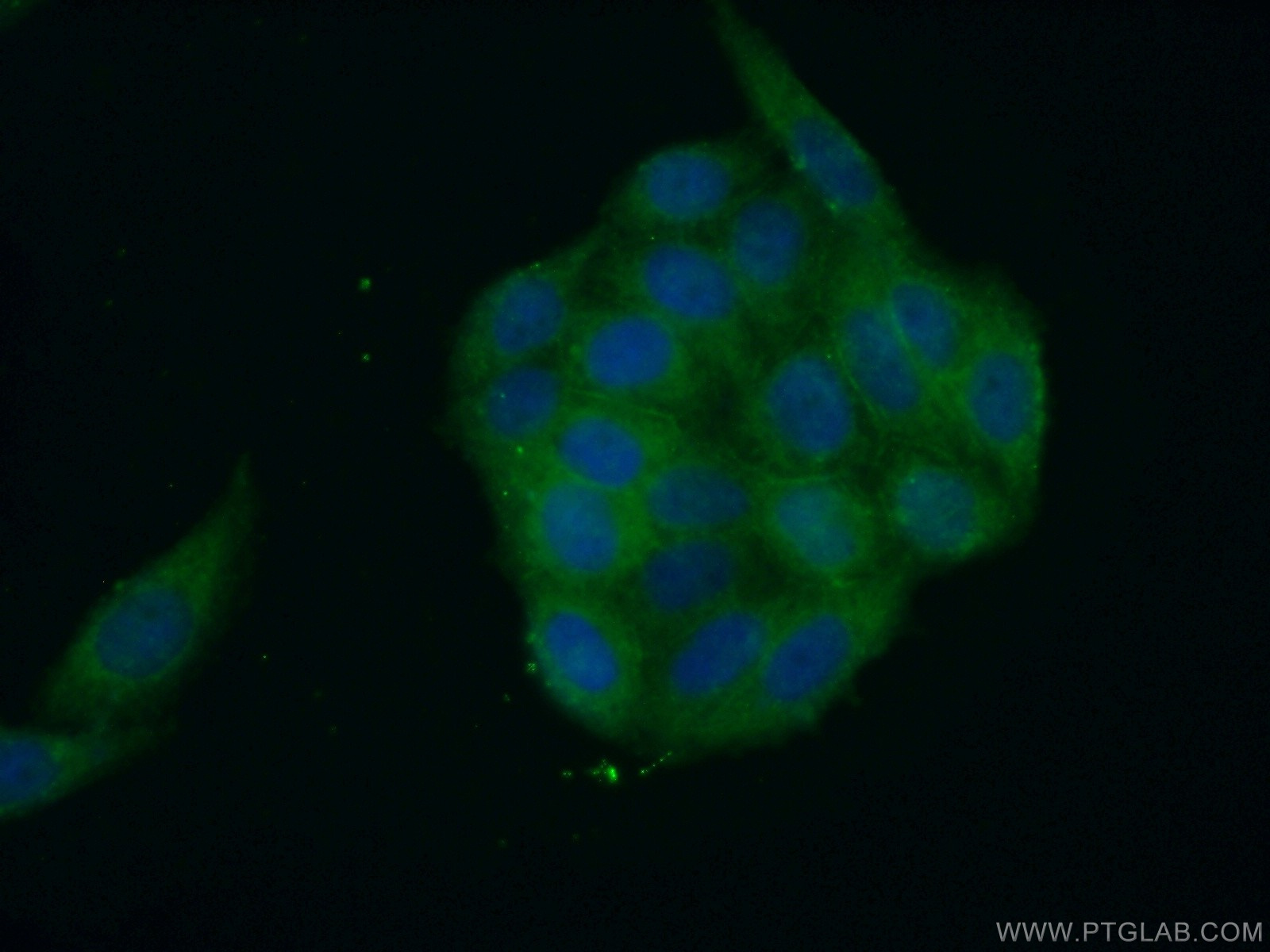 IF Staining of HeLa using 15957-1-AP