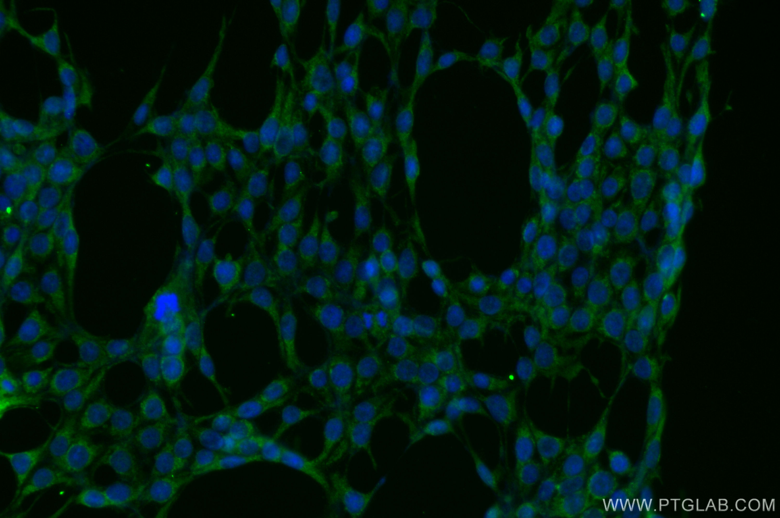 IF Staining of HEK-293 using 55320-1-AP