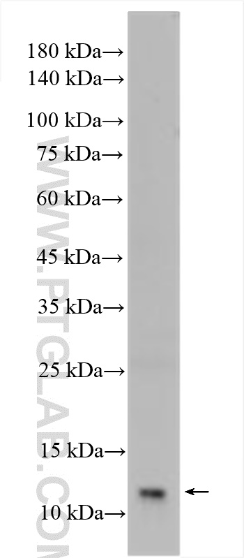 WB analysis of mouse colon using 11253-1-AP