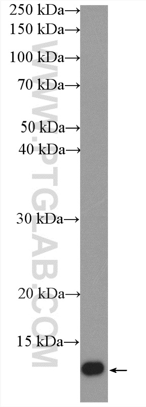 WB analysis of mouse brain using 21944-1-AP