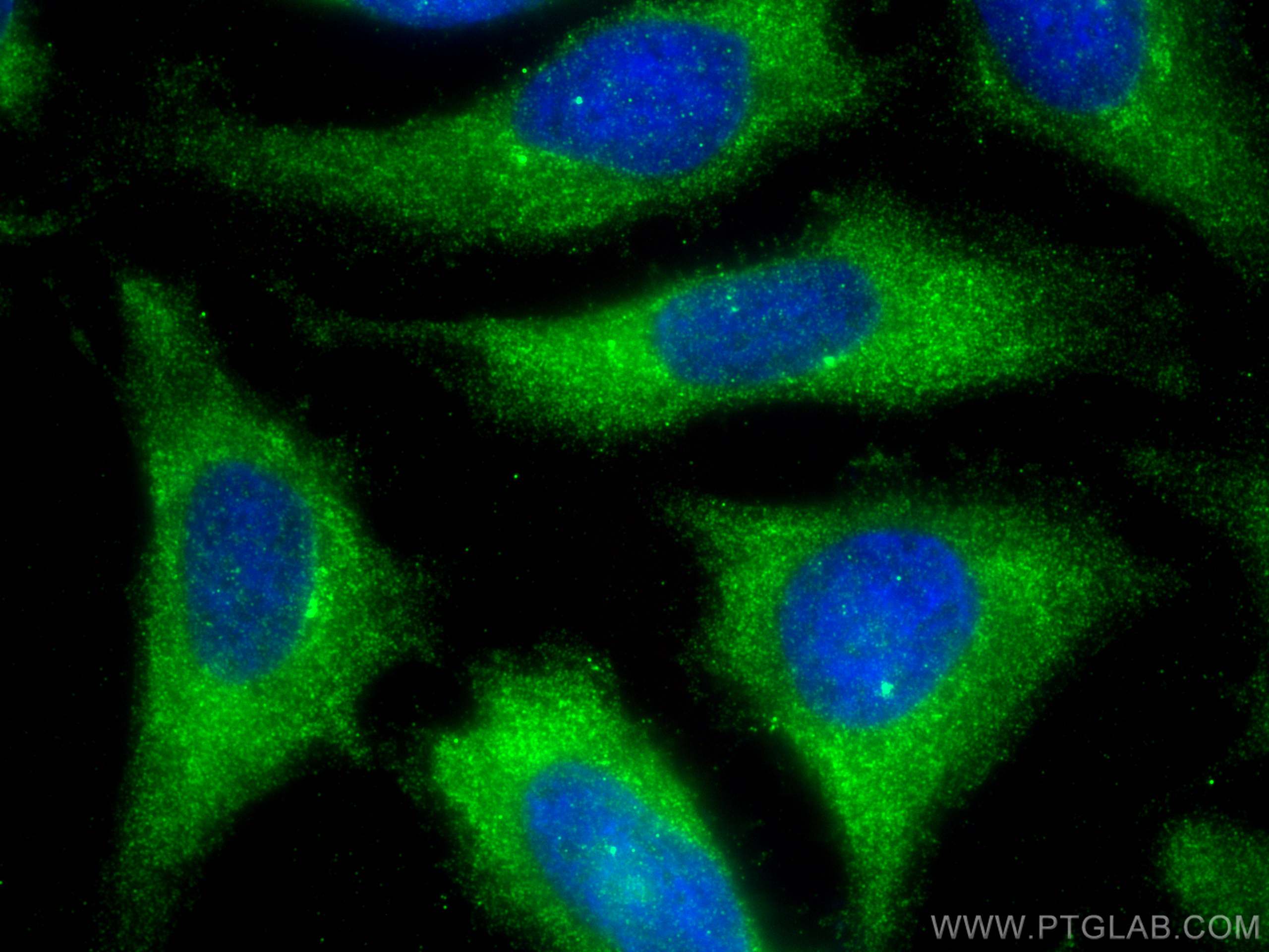 IF Staining of HeLa using 20541-1-AP