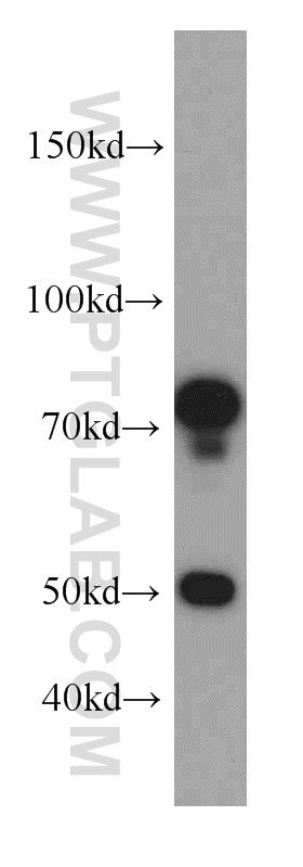 WB analysis of mouse lung using 20541-1-AP