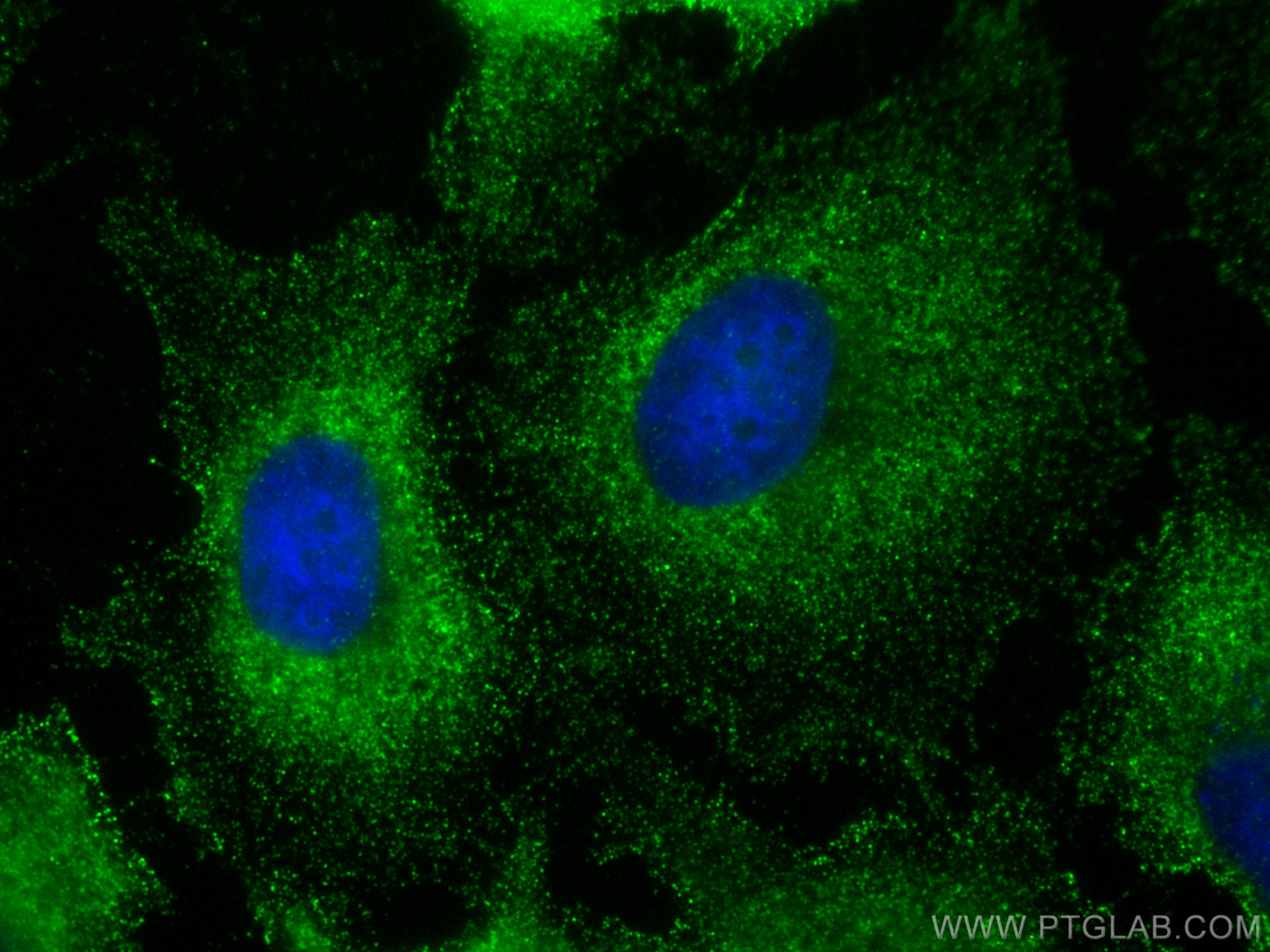 IF Staining of HeLa using 68328-1-Ig