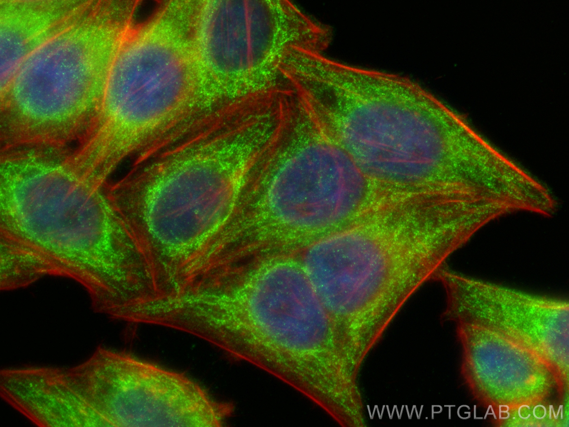 IF Staining of HepG2 using 15422-1-AP