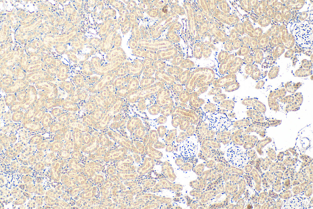 IHC staining of rat kidney using 15422-1-AP