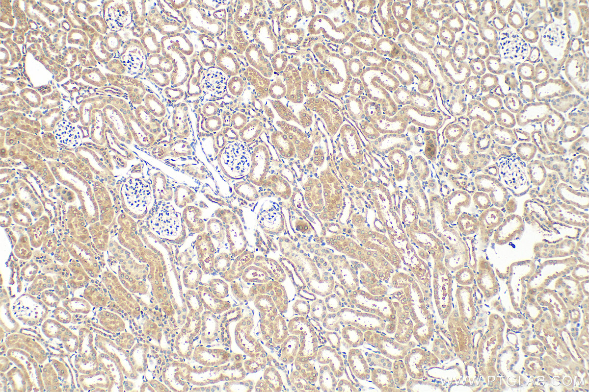 IHC staining of mouse kidney using 15422-1-AP