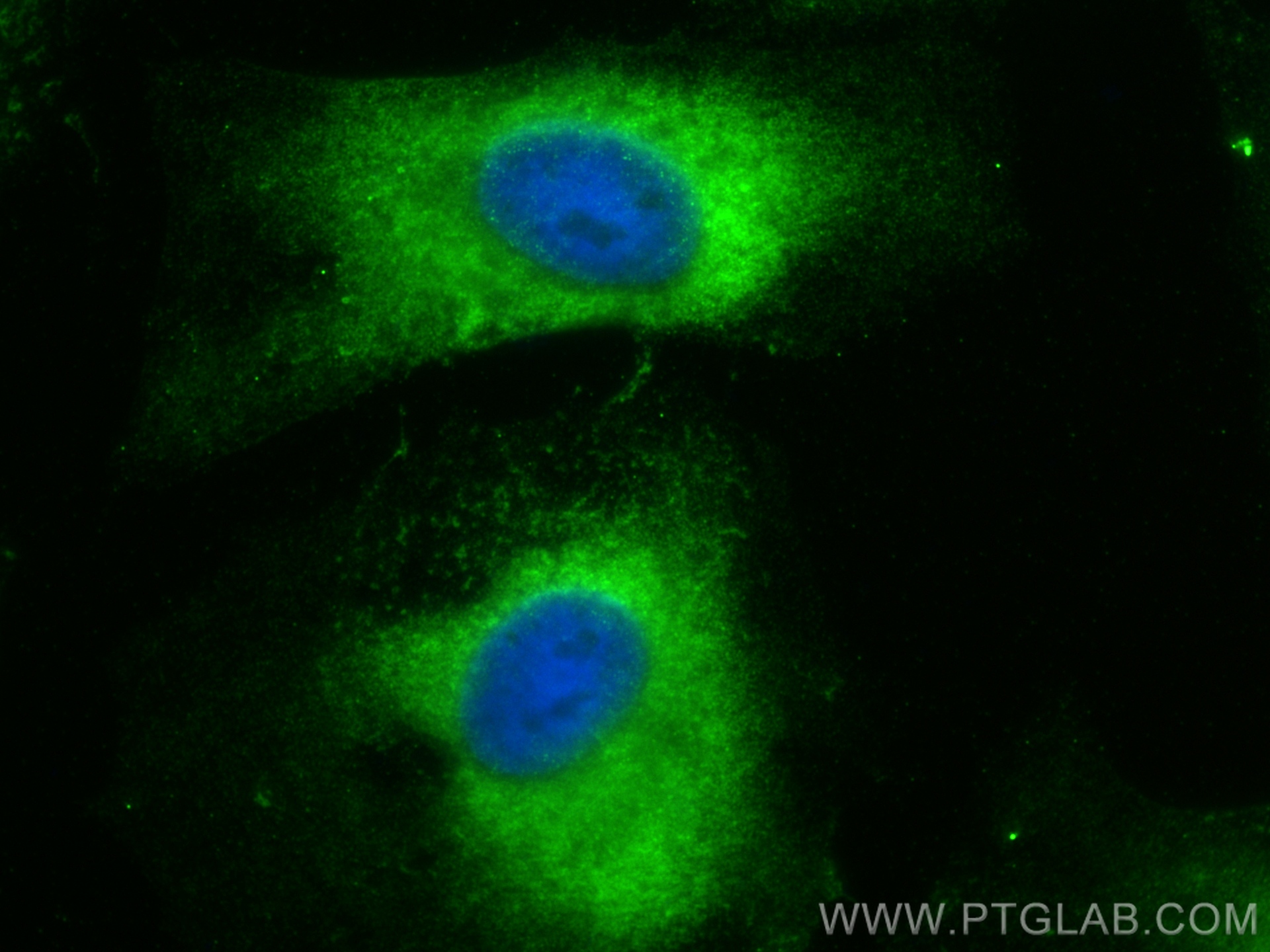 IF Staining of HeLa using 15897-1-AP