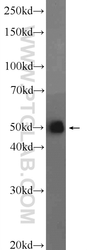 WB analysis of HeLa using 15897-1-AP