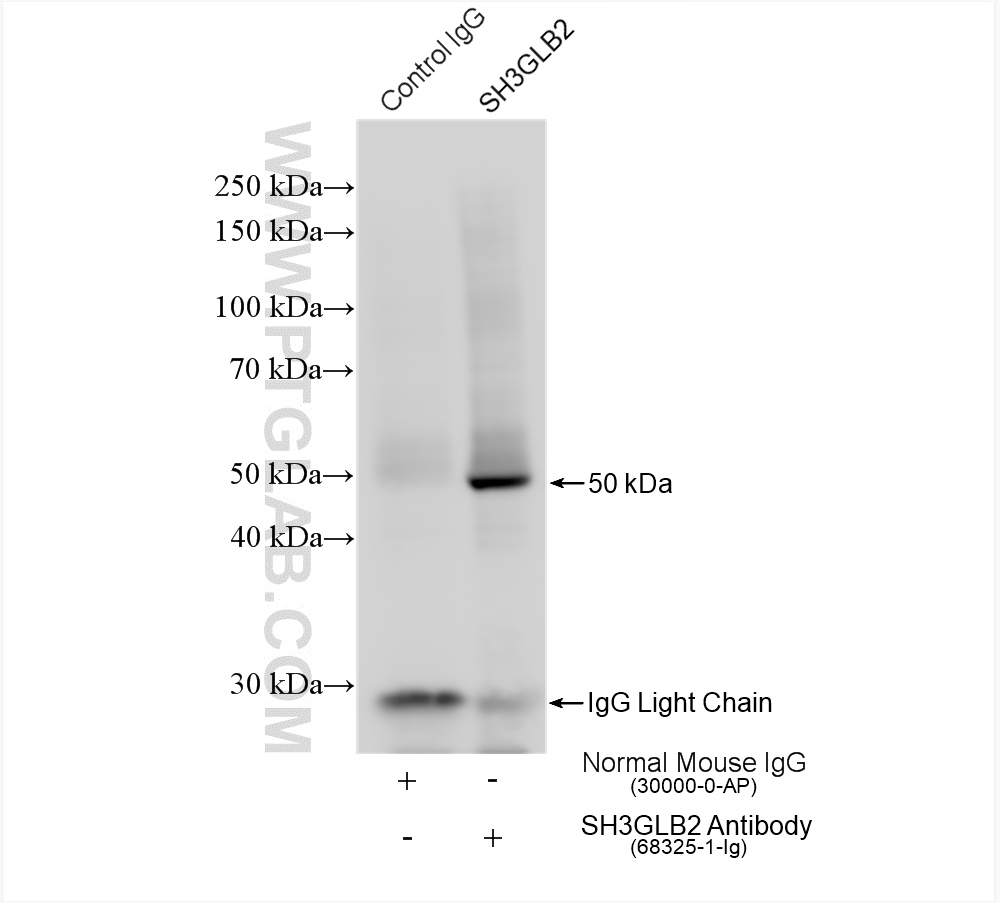 IP experiment of HeLa using 68325-1-Ig (same clone as 68325-1-PBS)