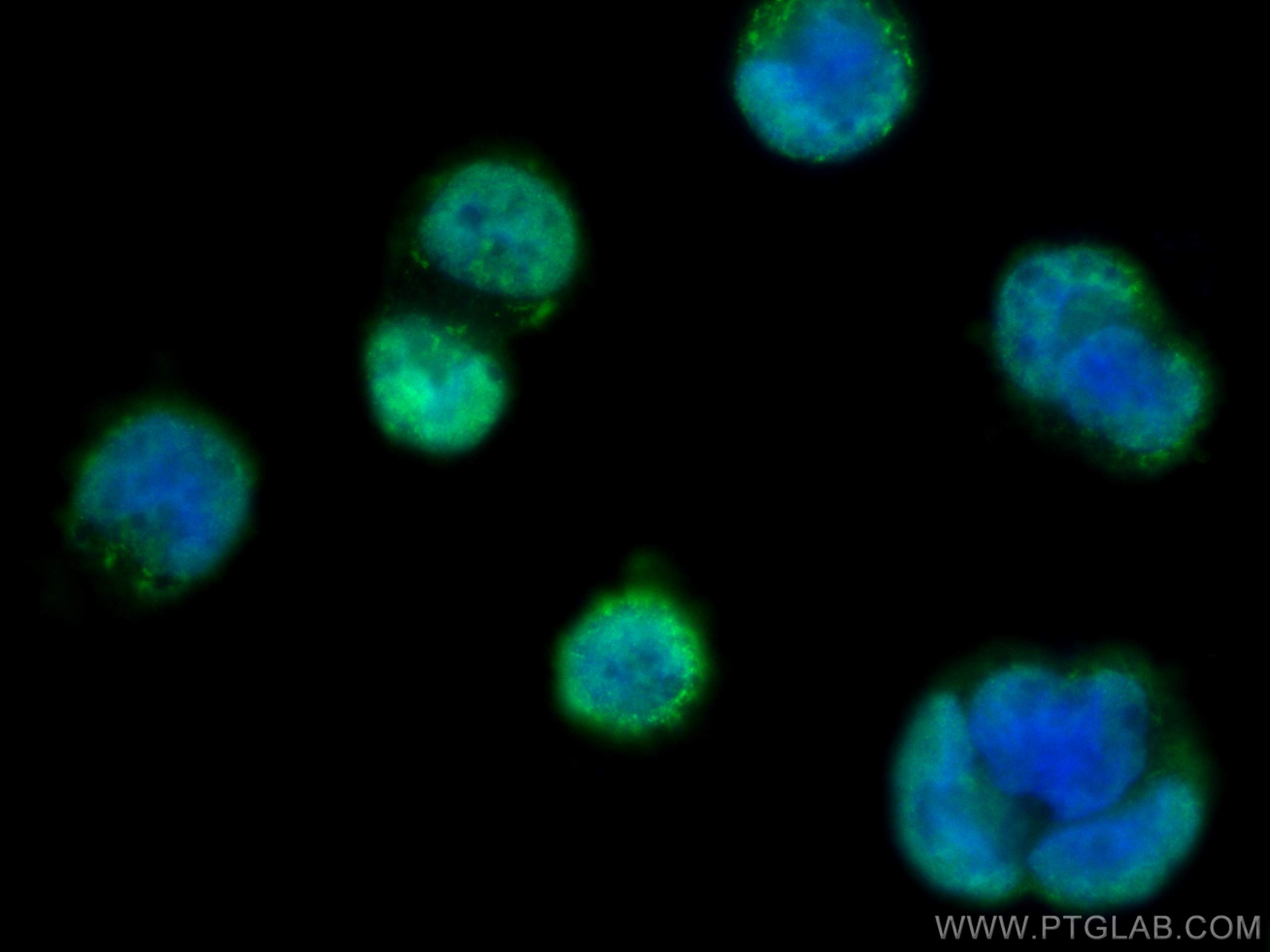 IF Staining of Caco-2 using 13306-1-AP