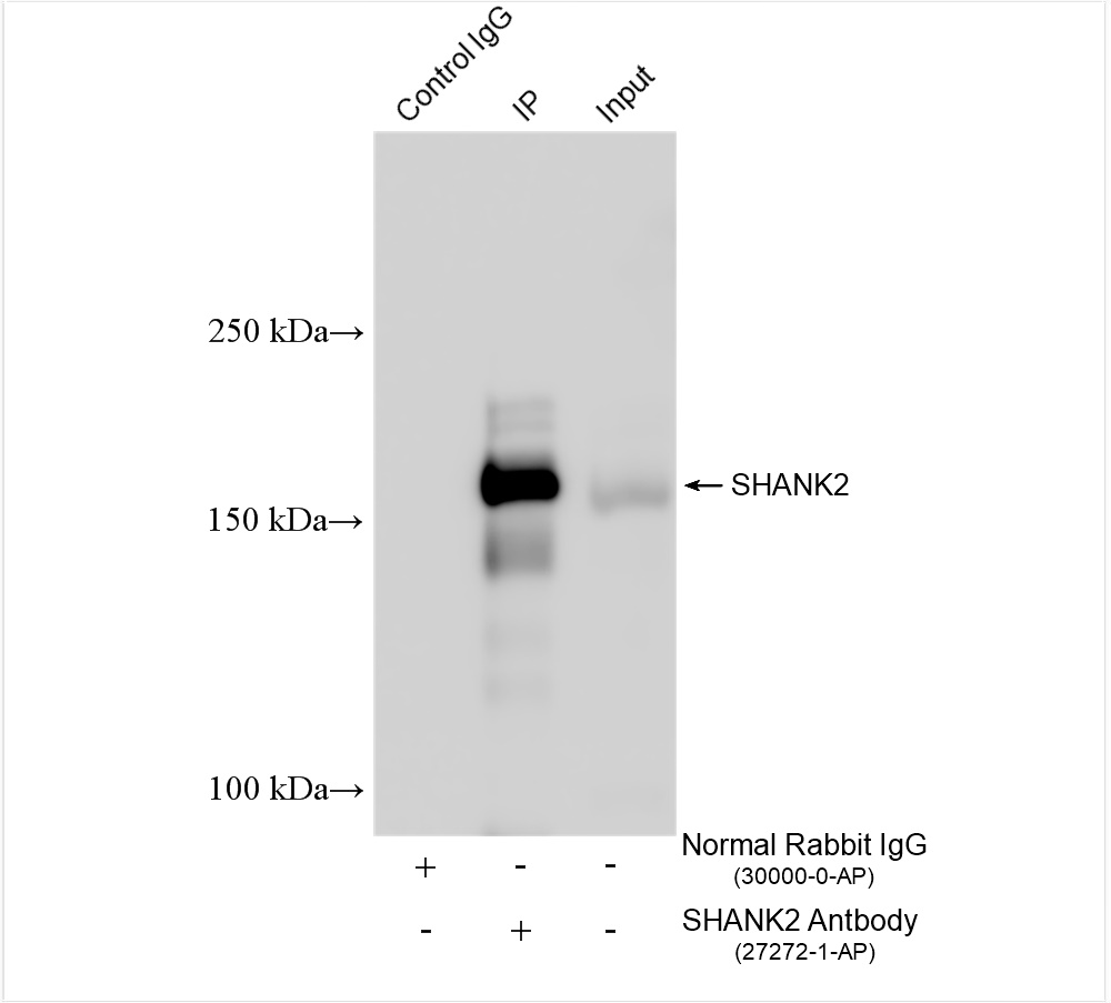 IP experiment of mouse brain using 27272-1-AP