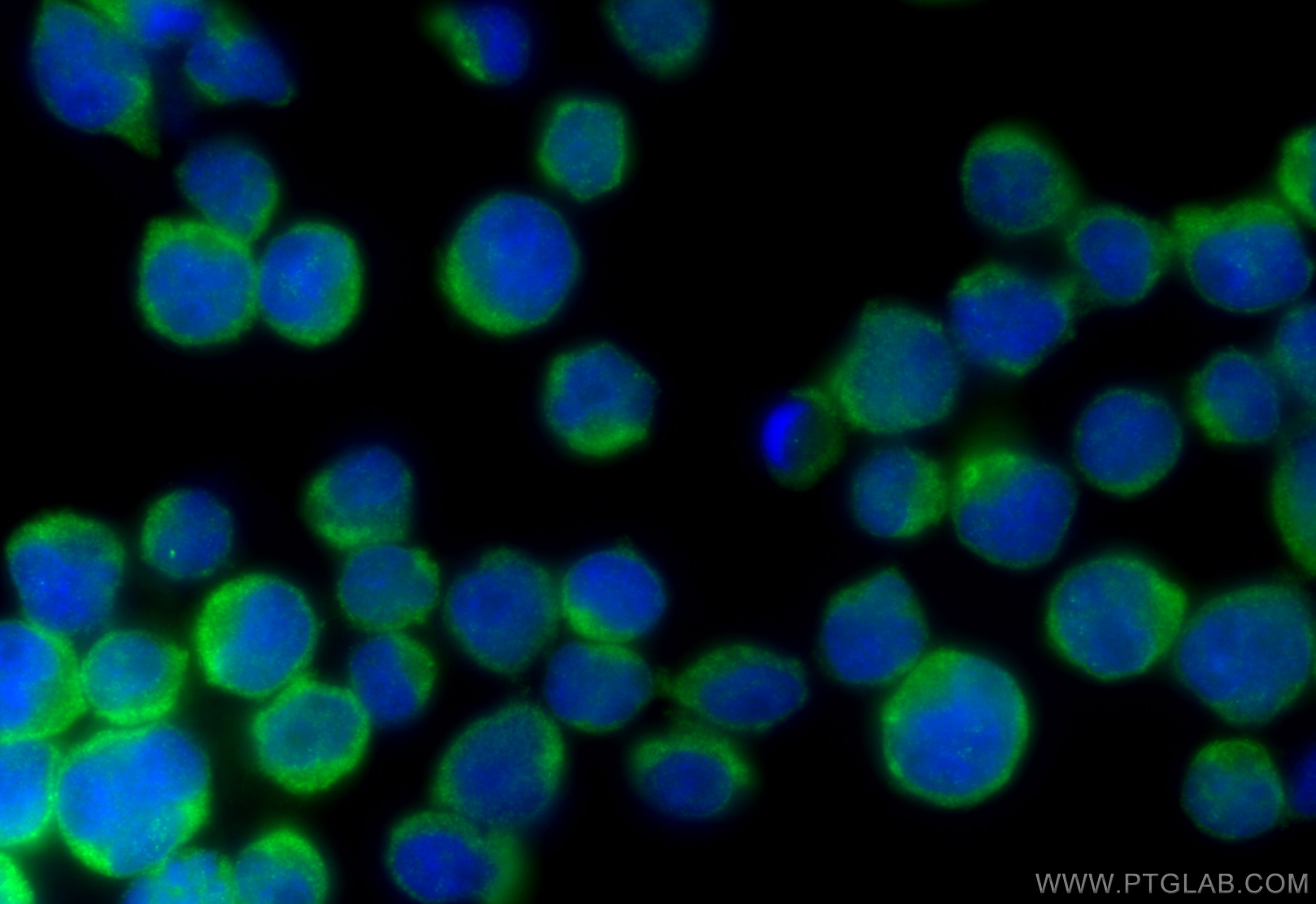 IF Staining of Jurkat using 14626-1-AP