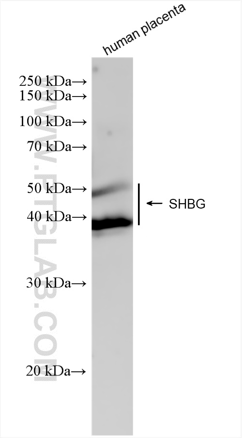 WB analysis of human placenta using 83096-1-RR (same clone as 83096-1-PBS)