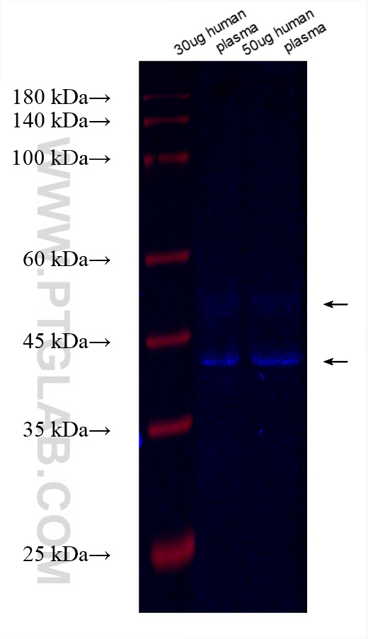 WB analysis of human plasma using CL750-83096