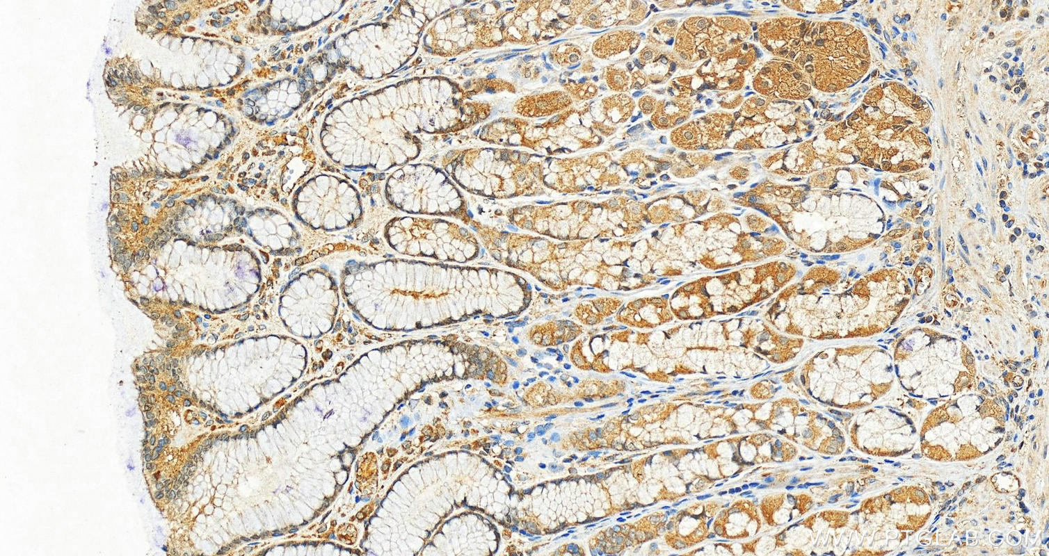 IHC staining of human stomach using 12496-1-AP