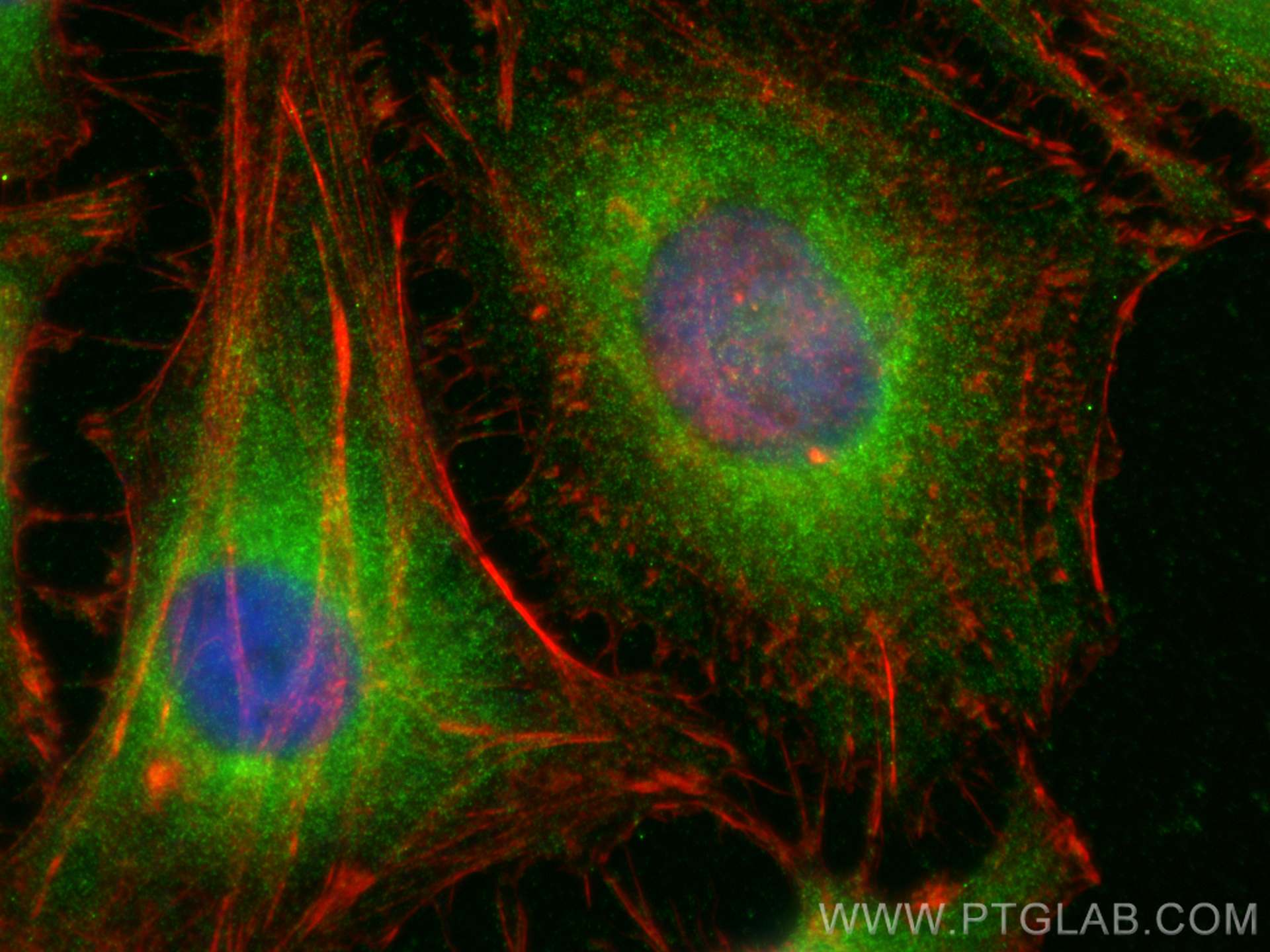 IF Staining of HeLa using 12496-1-AP