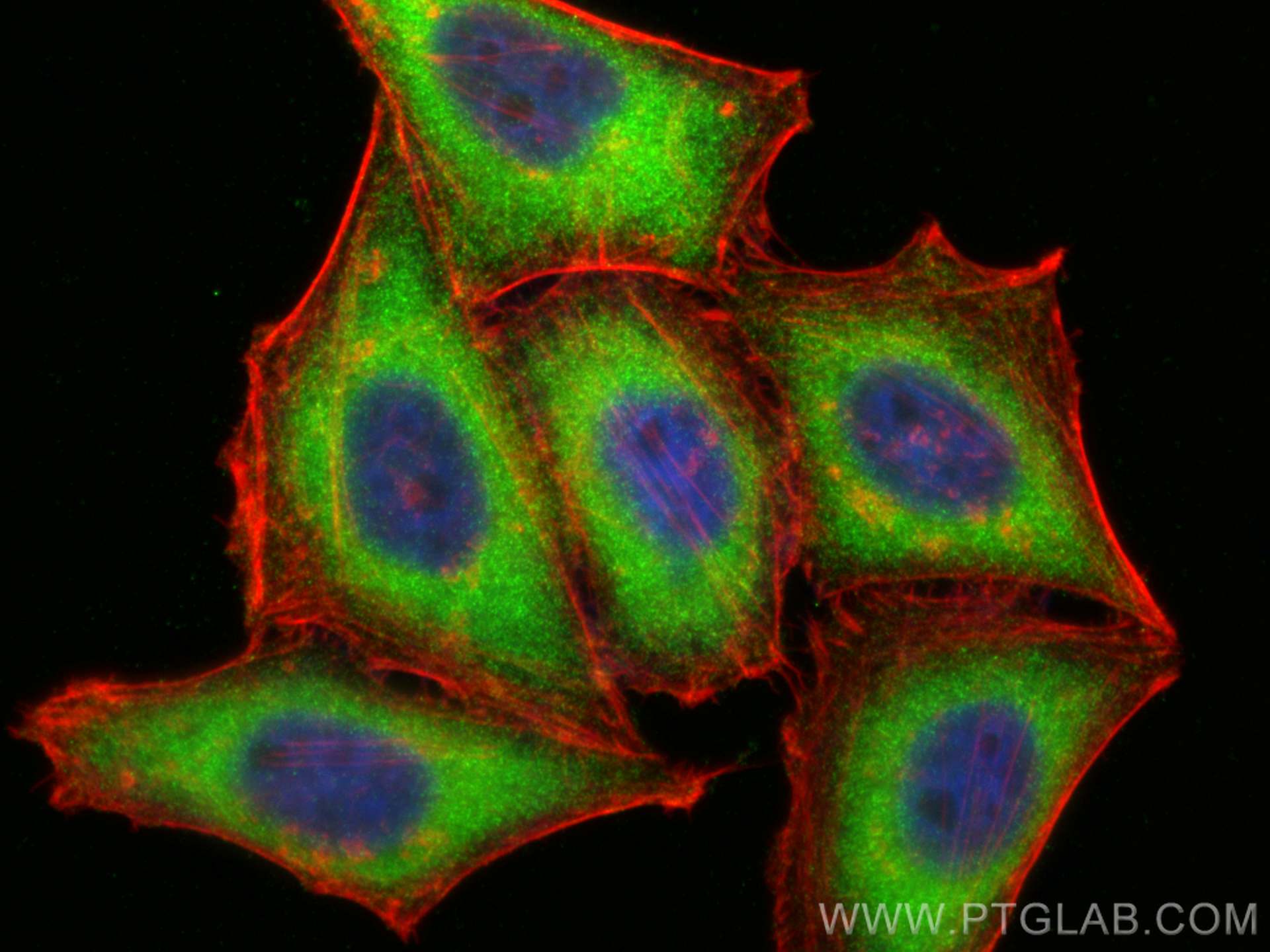 IF Staining of HepG2 using 12496-1-AP