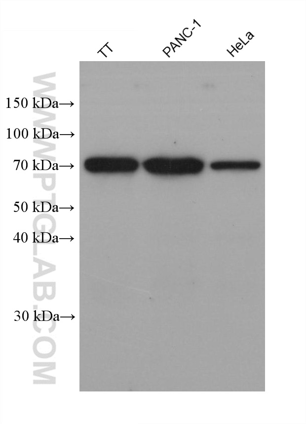 WB analysis using 67194-2-Ig