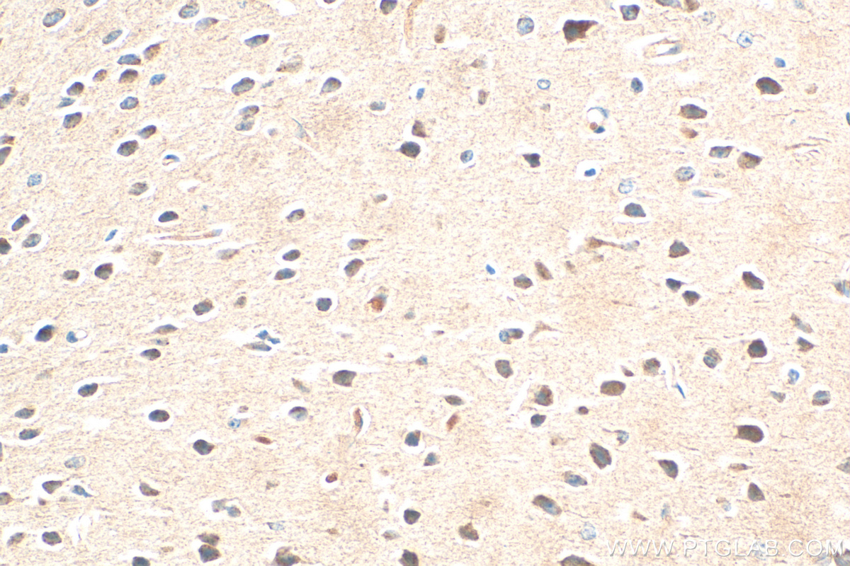 IHC staining of mouse brain using 12641-1-AP