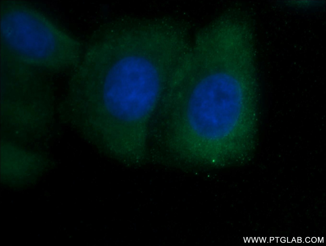 IF Staining of HepG2 using 22902-1-AP