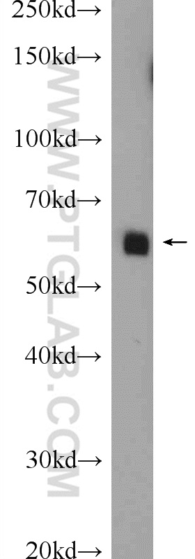 WB analysis of mouse testis using 22902-1-AP