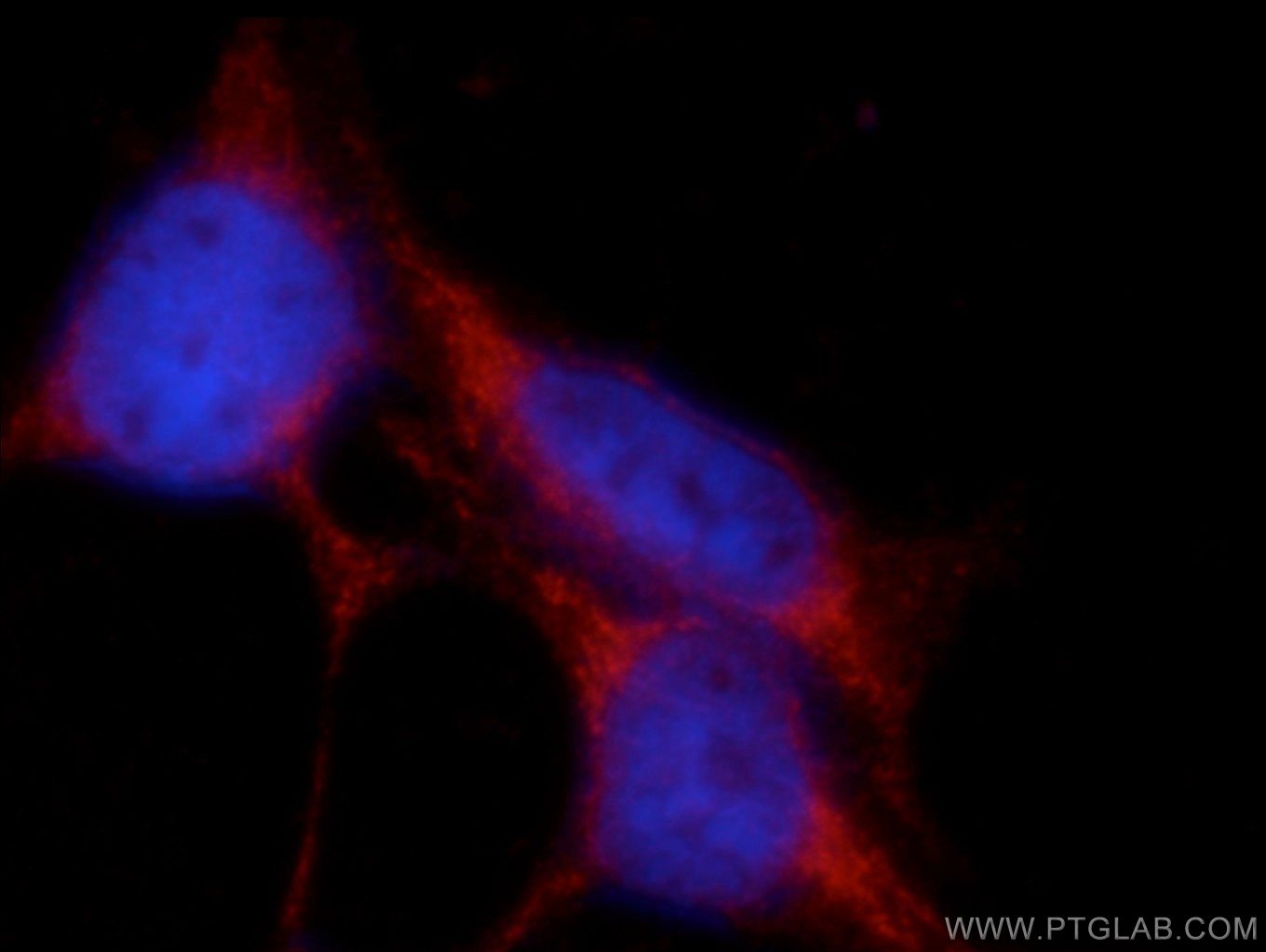 IF Staining of HEK-293 using 22197-1-AP (same clone as 22197-1-PBS)