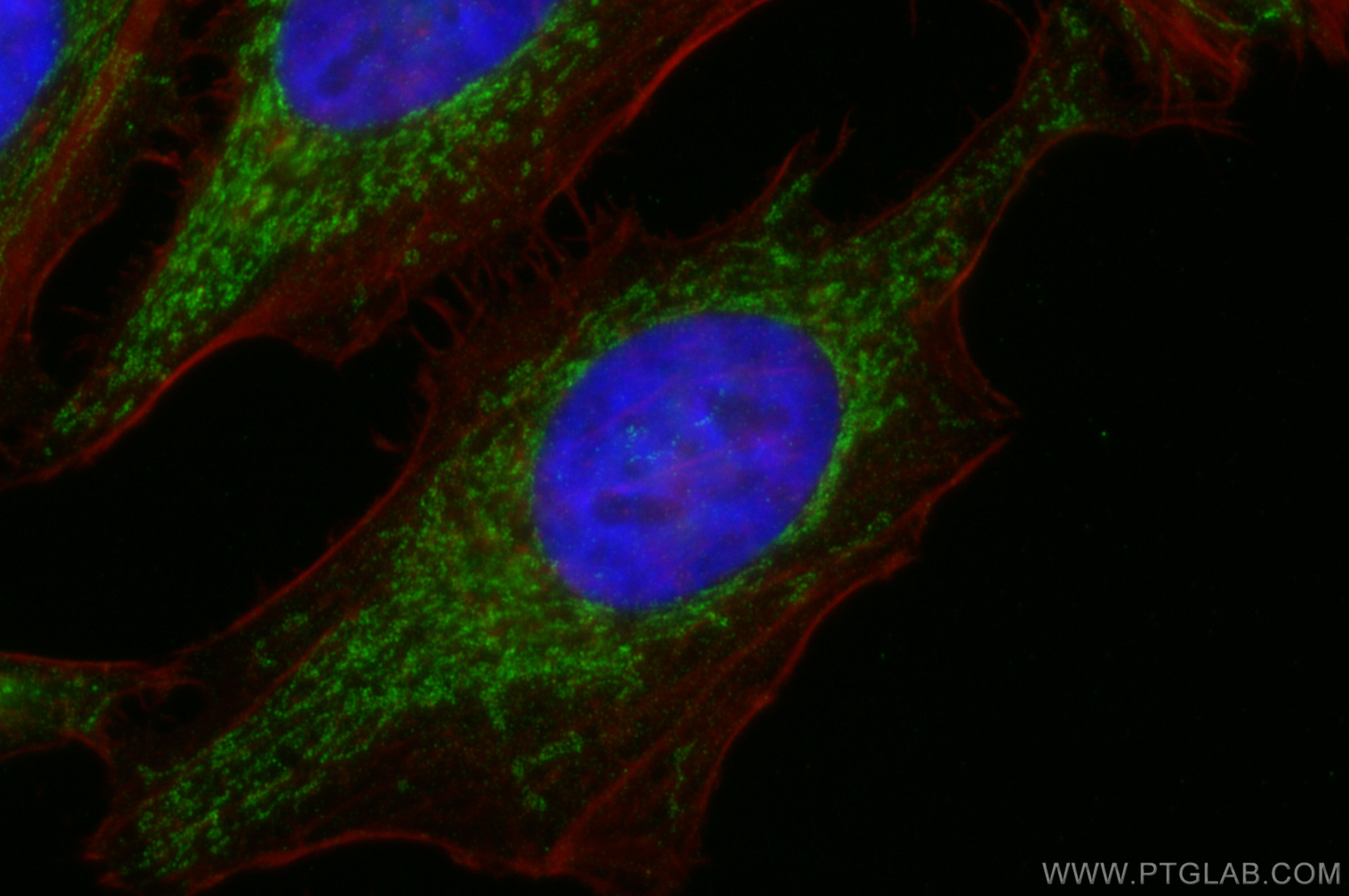 IF Staining of HeLa using 11099-1-AP