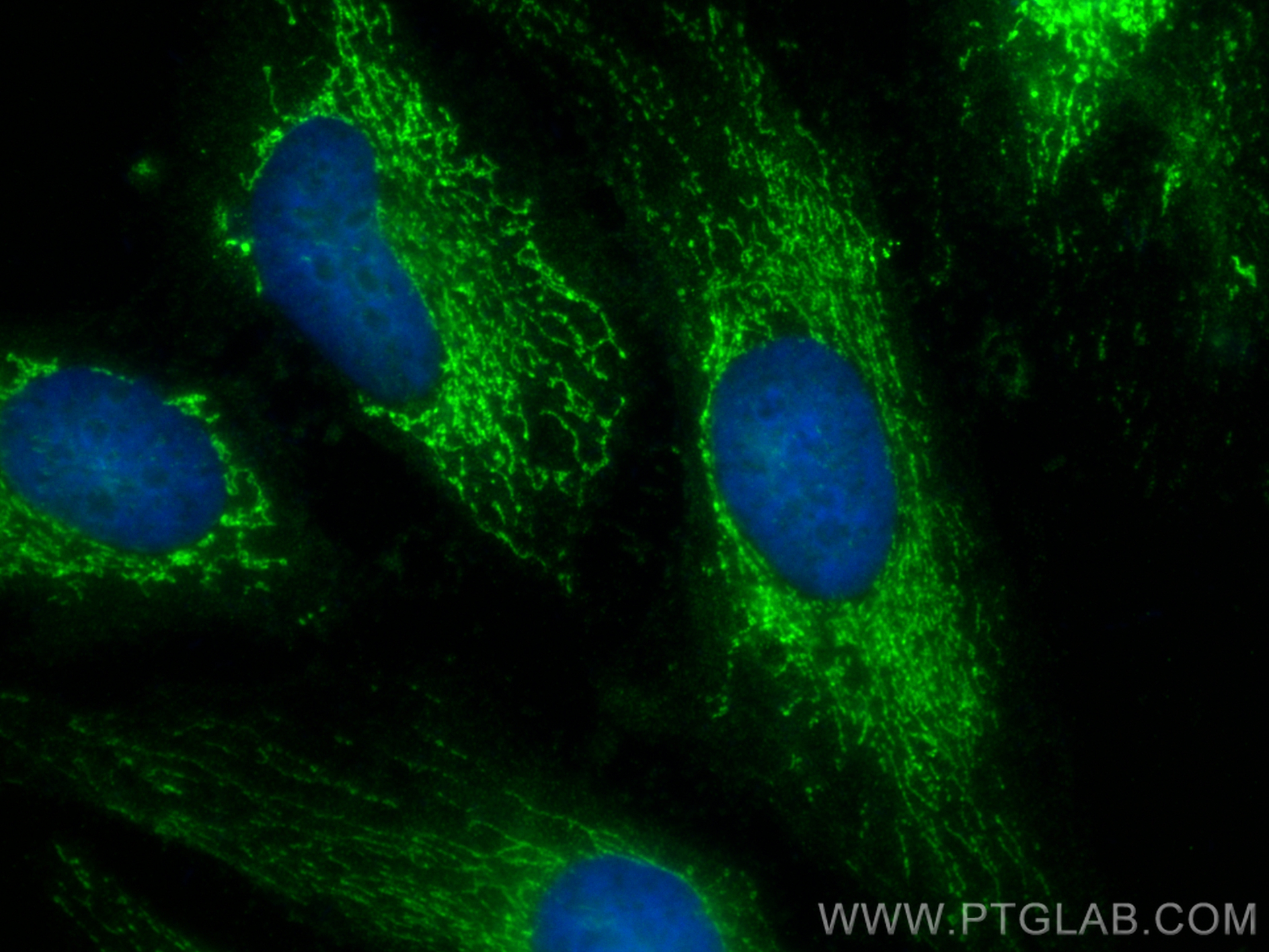 IF Staining of HeLa using 11099-1-AP