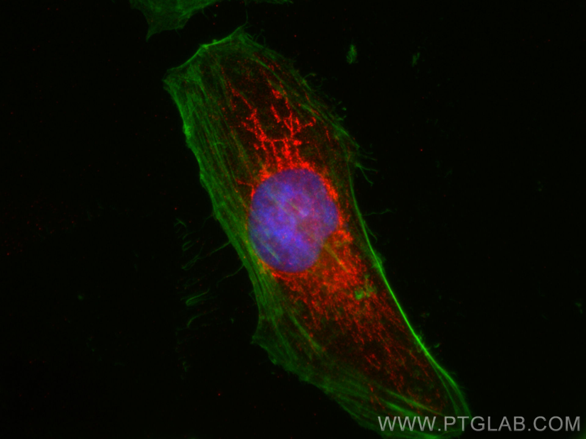 IF Staining of HeLa using 11099-1-AP