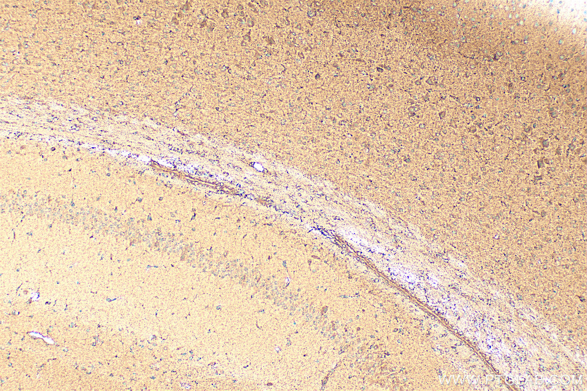 IHC staining of mouse brain using 11099-1-AP