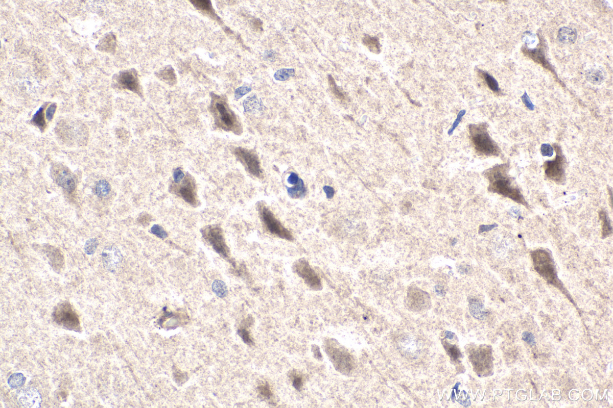 IHC staining of rat brain using 16366-1-AP