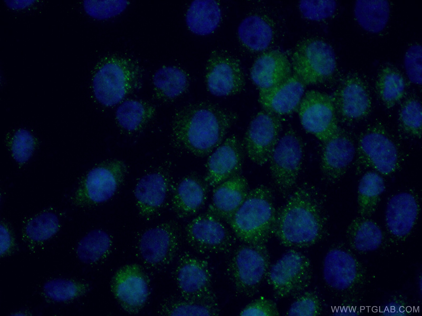 IF Staining of A431 using 27020-1-AP