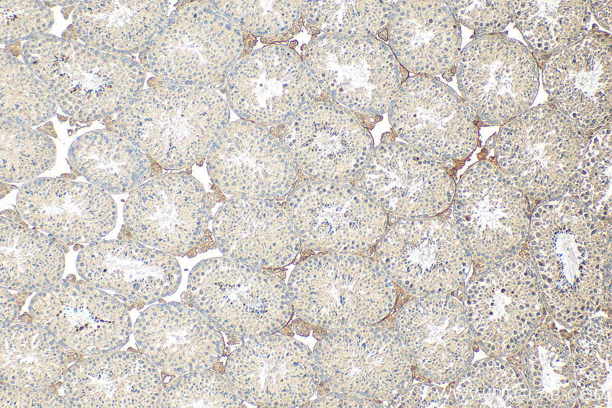 IHC staining of mouse testis using 13886-1-AP