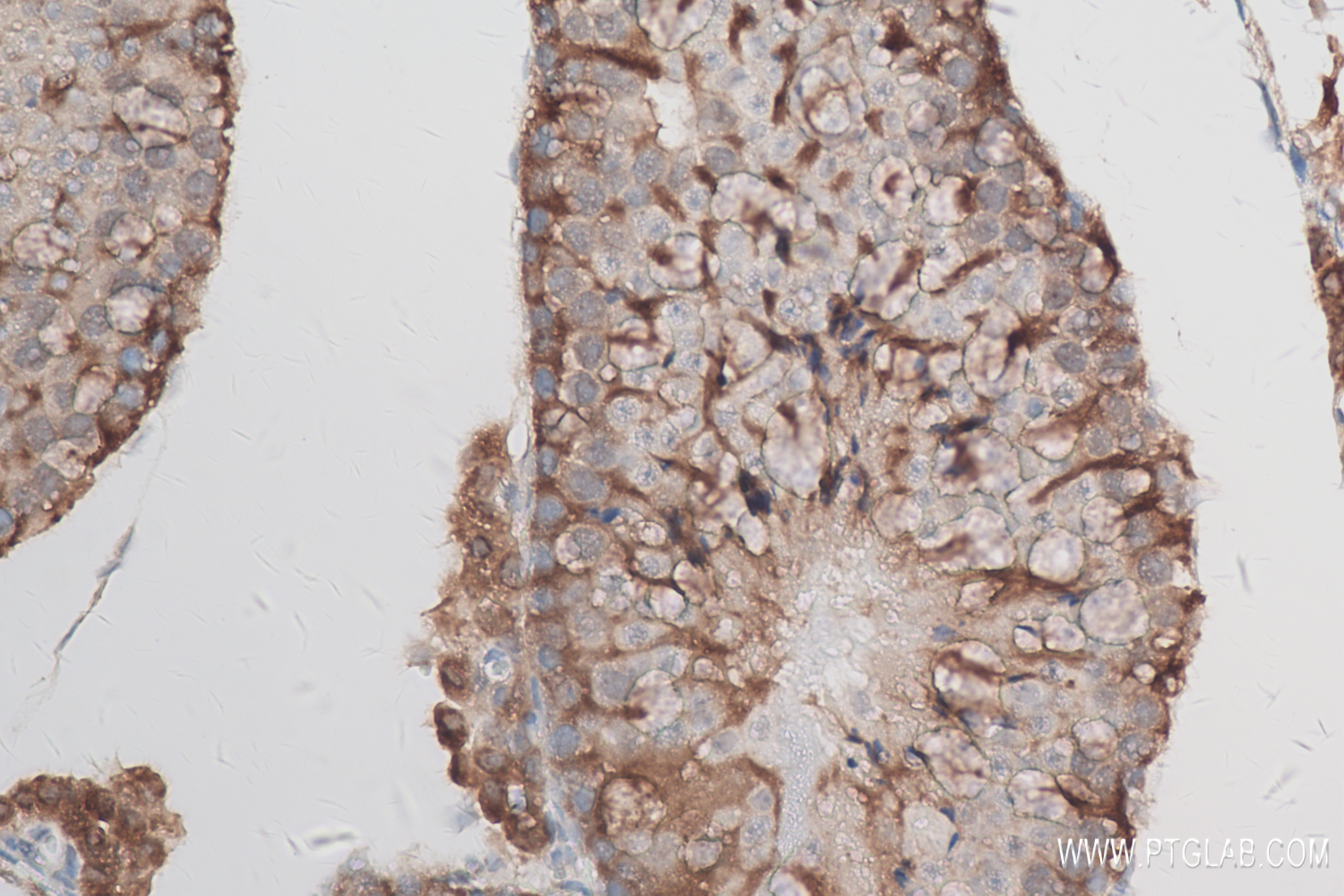 IHC staining of mouse testis using 83389-4-RR (same clone as 83389-4-PBS)