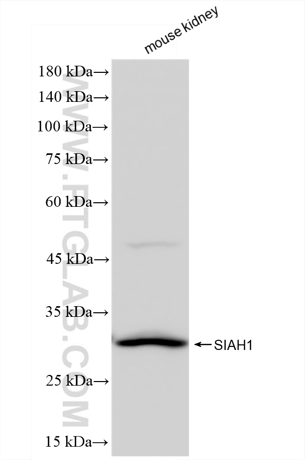 WB analysis of mouse kidney using 83389-4-RR