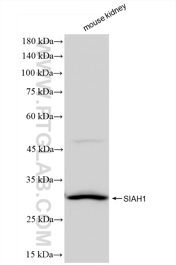 WB analysis of mouse kidney using 83389-4-RR (same clone as 83389-4-PBS)