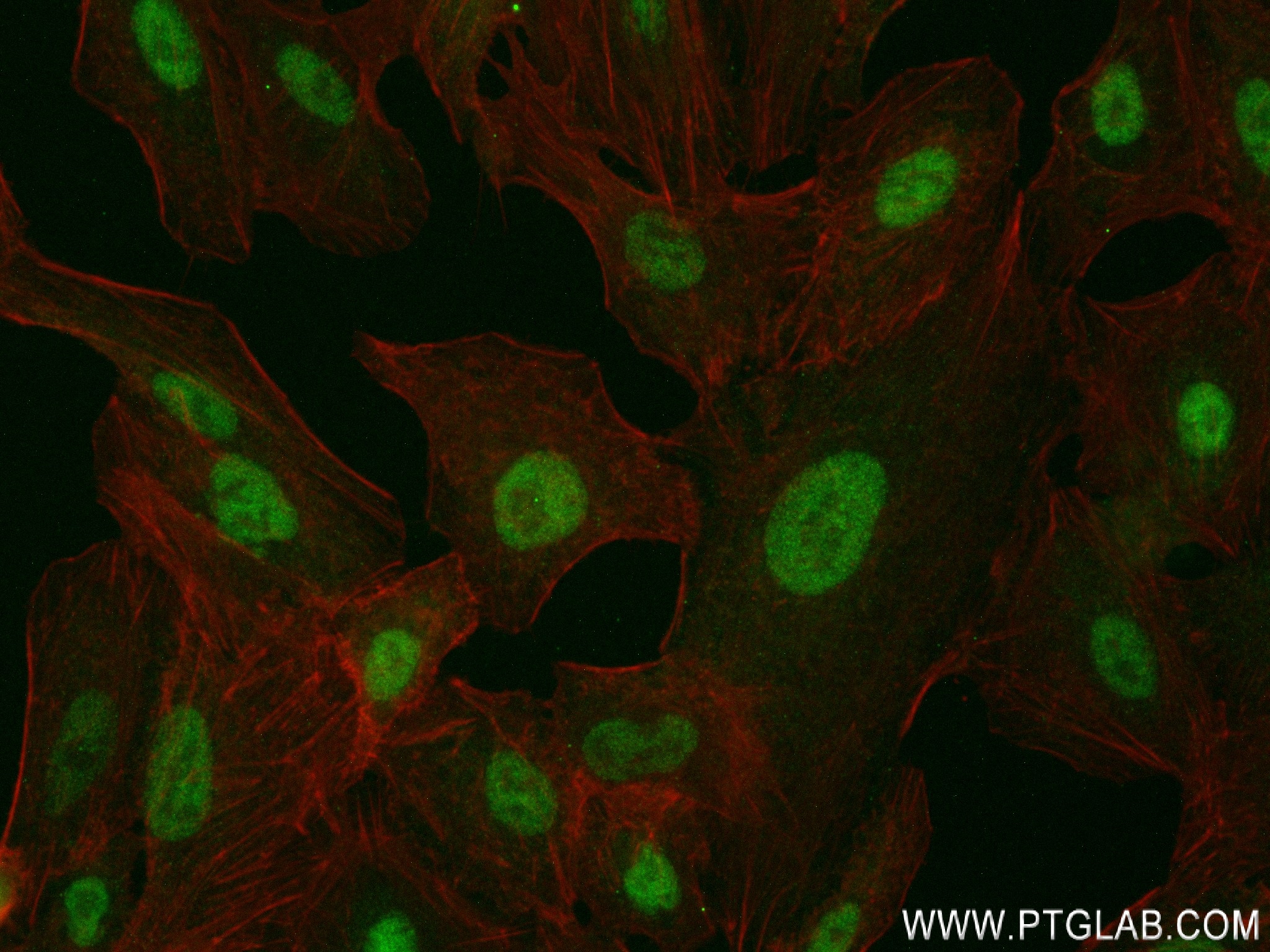 IF Staining of A549 using 83897-4-RR (same clone as 83897-4-PBS)